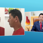 Milton Seigi Hayashi defende uma cirurgia plástica ética, focada em resultados naturais e na valorização da identidade individual.