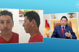 Milton Seigi Hayashi defende uma cirurgia plástica ética, focada em resultados naturais e na valorização da identidade individual.