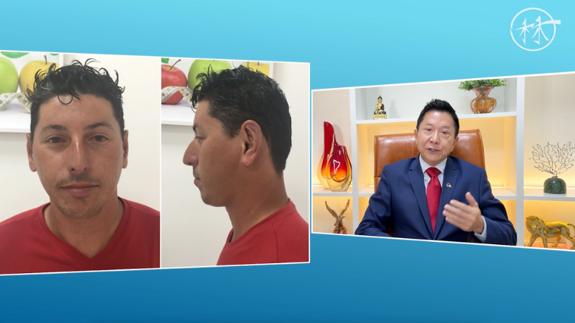 Milton Seigi Hayashi defende uma cirurgia plástica ética, focada em resultados naturais e na valorização da identidade individual.